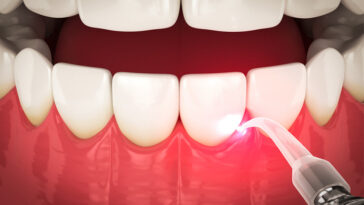 An image showing a dentist examining a patient's teeth, with dental tools and equipment in the background, highlighting the importance of oral health and gum disease management.