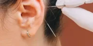 Ear wax removal salofrd​