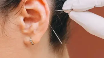 Ear wax removal salofrd​